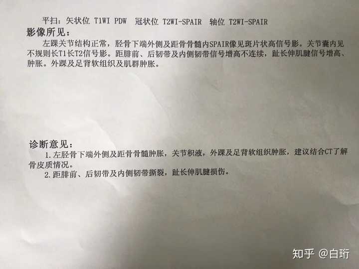 脚崴了伤到筋4个月都没好