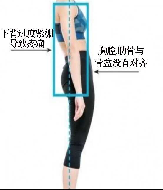 于是形成驼背,胸廓狭窄,且大腿向前推,膝盖窝后侧形成一个张开的钝角