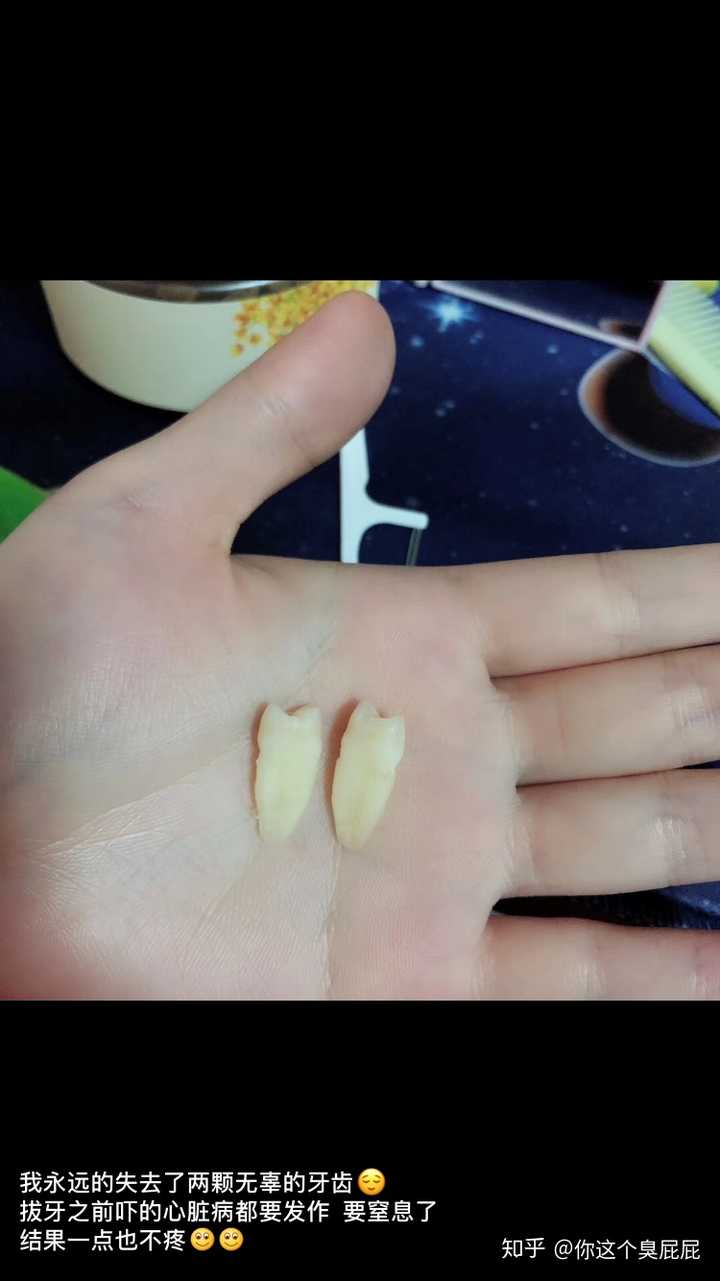 我还有一些伤口的愈合图片,如果你们想看我可以继续更新哈哈哈哈哈哈