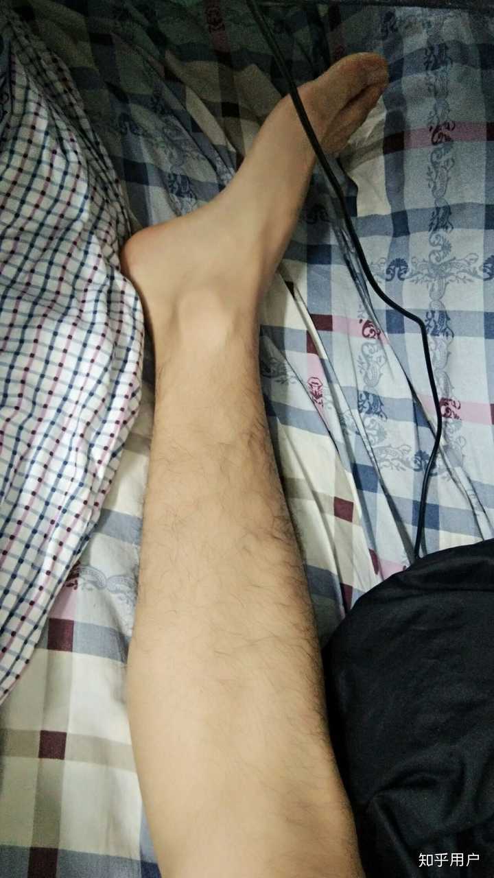 夏天男生穿短裤该不该褪毛呢?