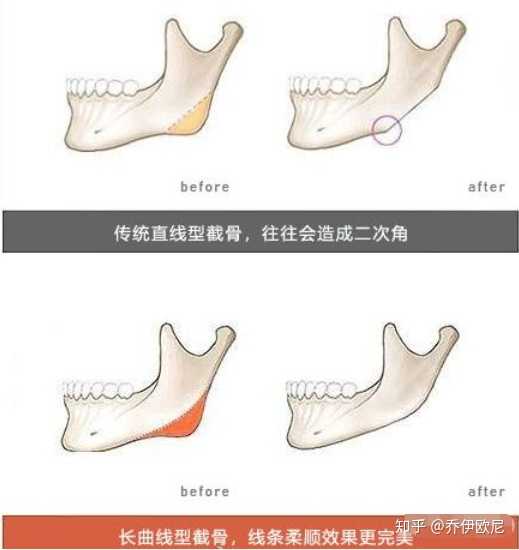 什么时候劈外板?