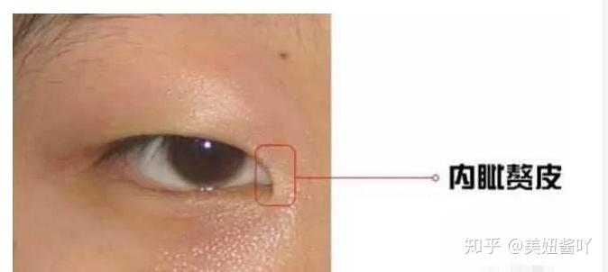 开内眼角手术呢,就是让这个红色泪阜露出来,这样眼裂长度是不是瞬间变