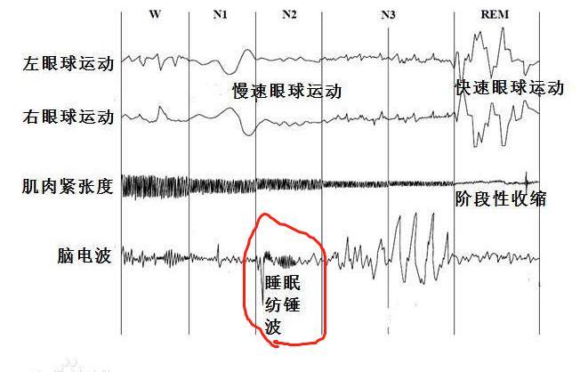 丘脑在睡眠中会产生一种名为纺锤波的脑电波,这种脑电波可以屏蔽一些