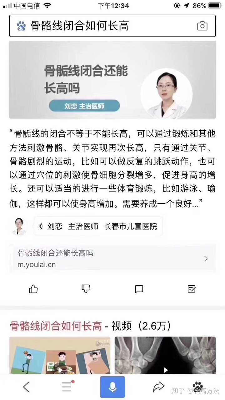 对于骨骺线闭合停止生长的人来说,增高就是依靠骨微裂实现了.