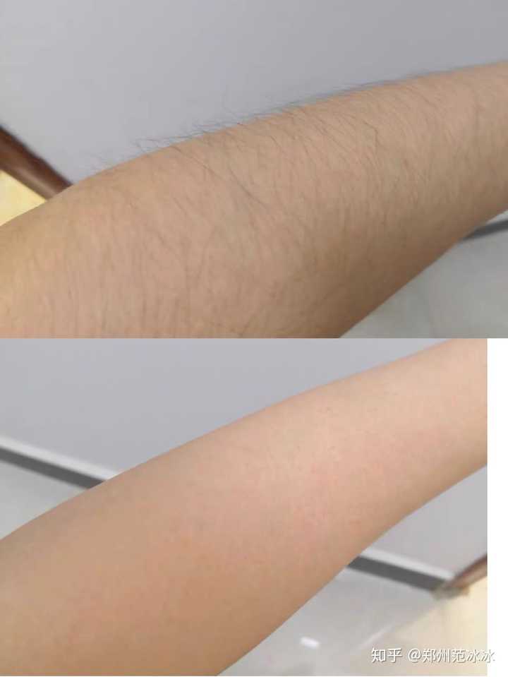 下面找找几个适合体毛多的女孩纸的产品说说!