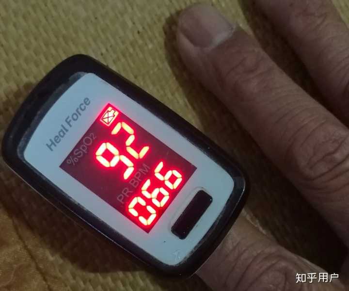 家里原本有制氧机,但是现在用得少,只用呼吸机氧饱和度也达到95以上