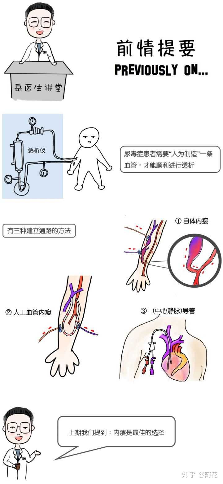 血液透析为什么要动静脉造瘘,造瘘有哪些优势?