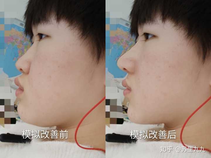 侧脸巨丑怎么办?