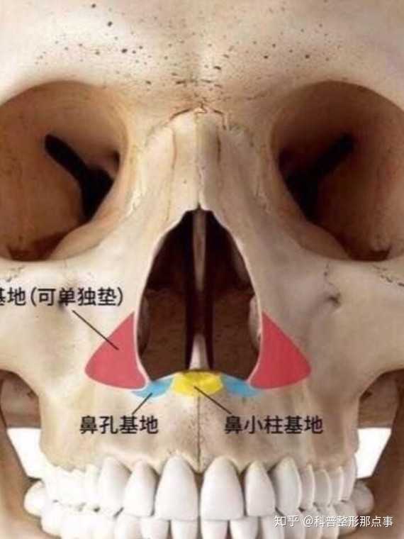 我们大多数的东方人都会有鼻基底凹陷的问题,这主要是由于上颌骨发育