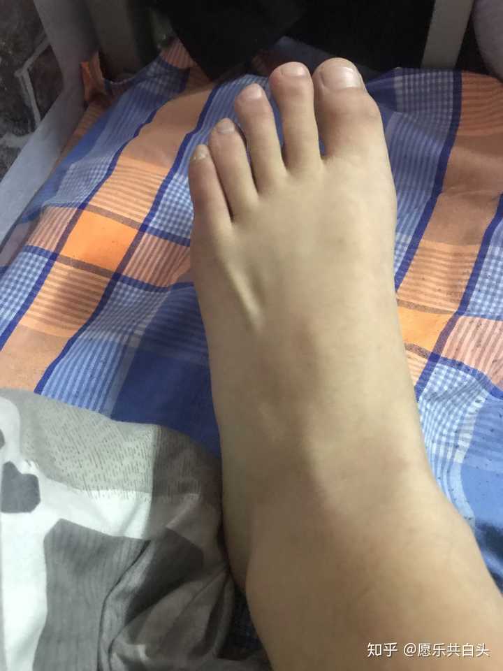 美女也有脚臭么?