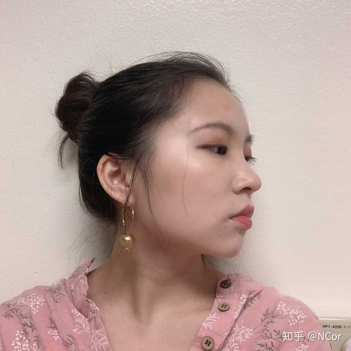 张嘴呼吸面容变丑能恢复吗?