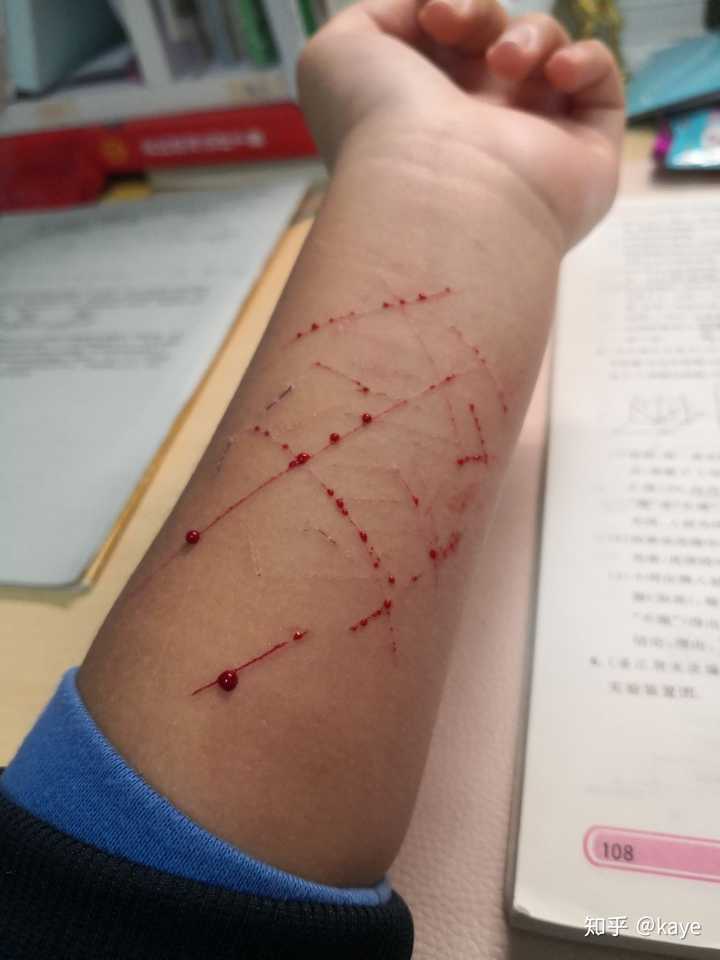 我也不知道 我是想让老师同学发现,至少找我聊聊吧 但是没有人发现
