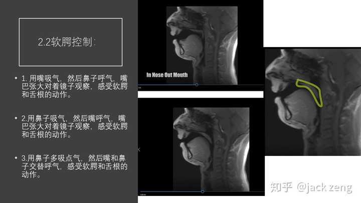 如何学习和训练法兰佐呢?