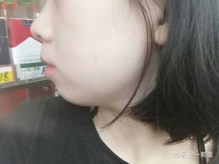 脸鼓没下巴的姑娘怎么变美?是不是没救了…?
