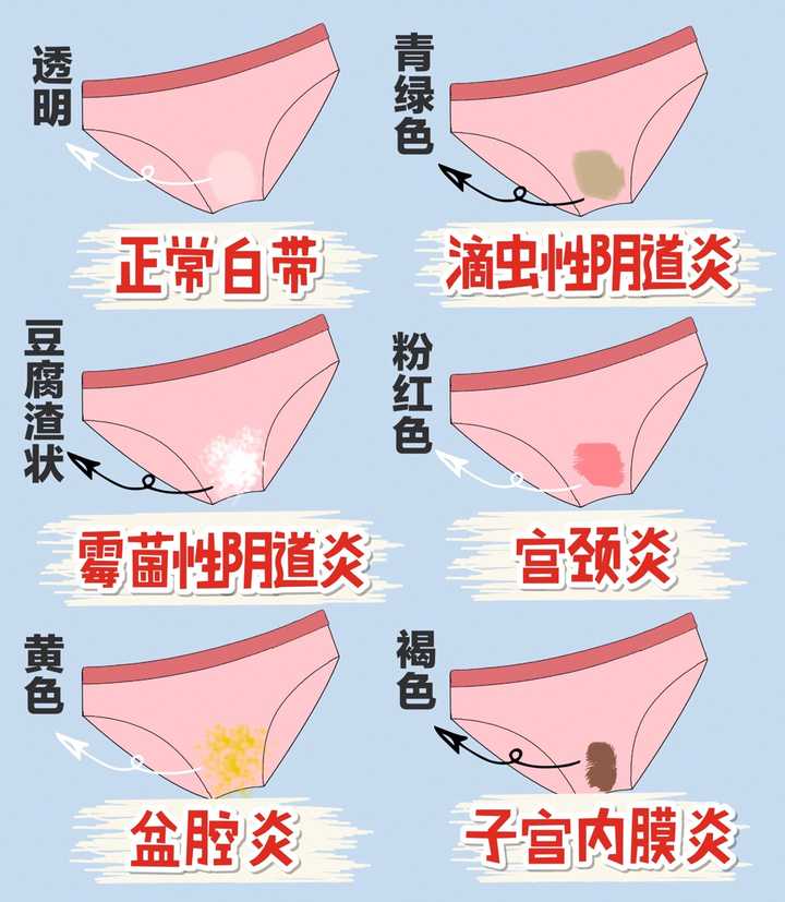 白带异常!颜色偏黄,带着异味等等问题,用凝胶来护理,帮助还是挺大的.