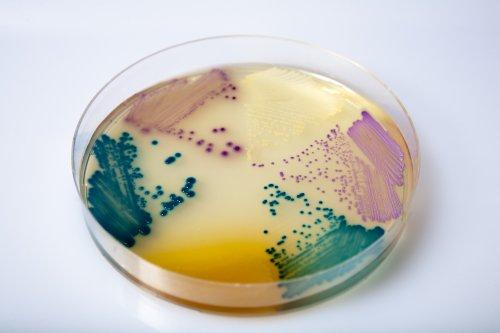细菌都是什么颜色的?一种细菌长在不同的营养物质上颜色一样吗?
