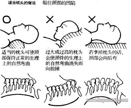程序员、白领如何保护自己的颈椎 程序员、白领如何保护自己的颈椎