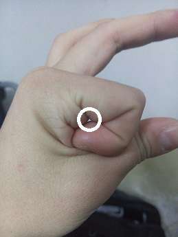 [​IMG]
