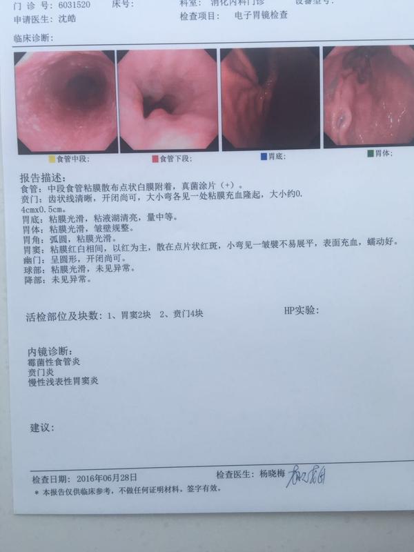 麻烦懂医的网友帮忙看看胃镜检查结果.这种情况为什么