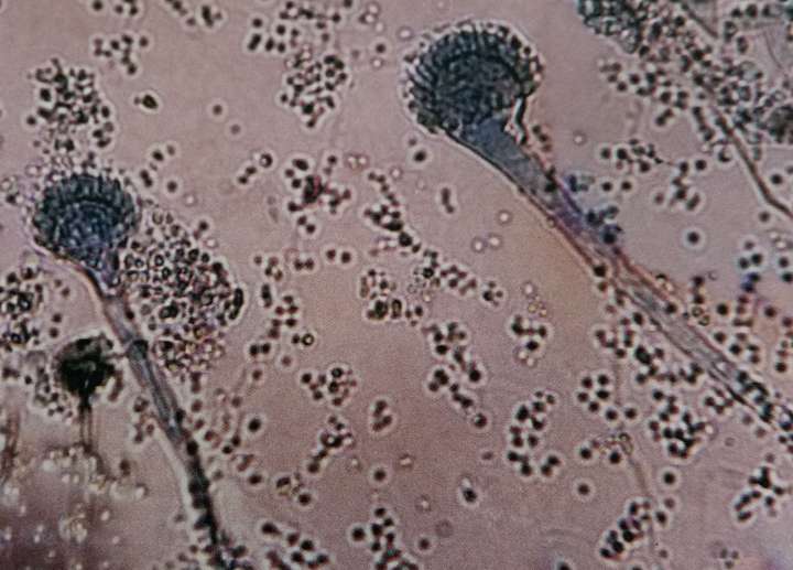 黄曲霉在pda上两周的菌落特征 霉菌经过简单染色以后就可以在显微镜