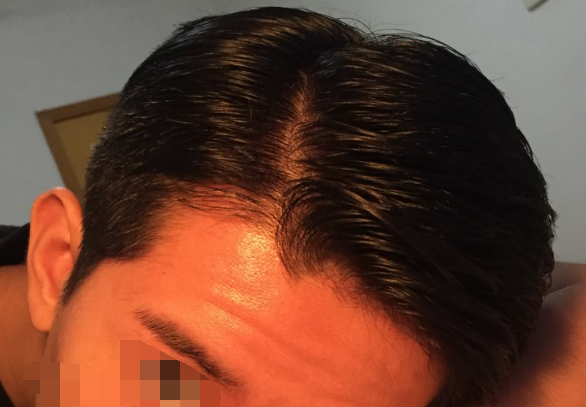 油头的鬓角老是翘起来怎么办?