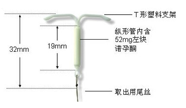 普通节育环能代替曼月乐么 曼月乐避孕环多少钱
