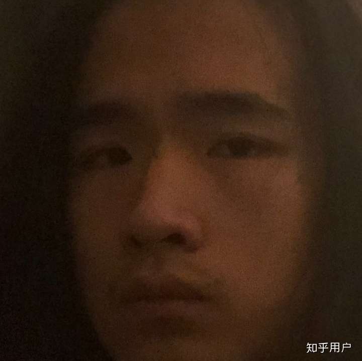 抑郁的人眼神都很空洞吗?