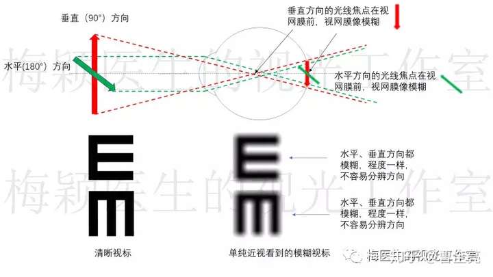 300度近视,没有散光时,成像在各个方向都是一样的模糊