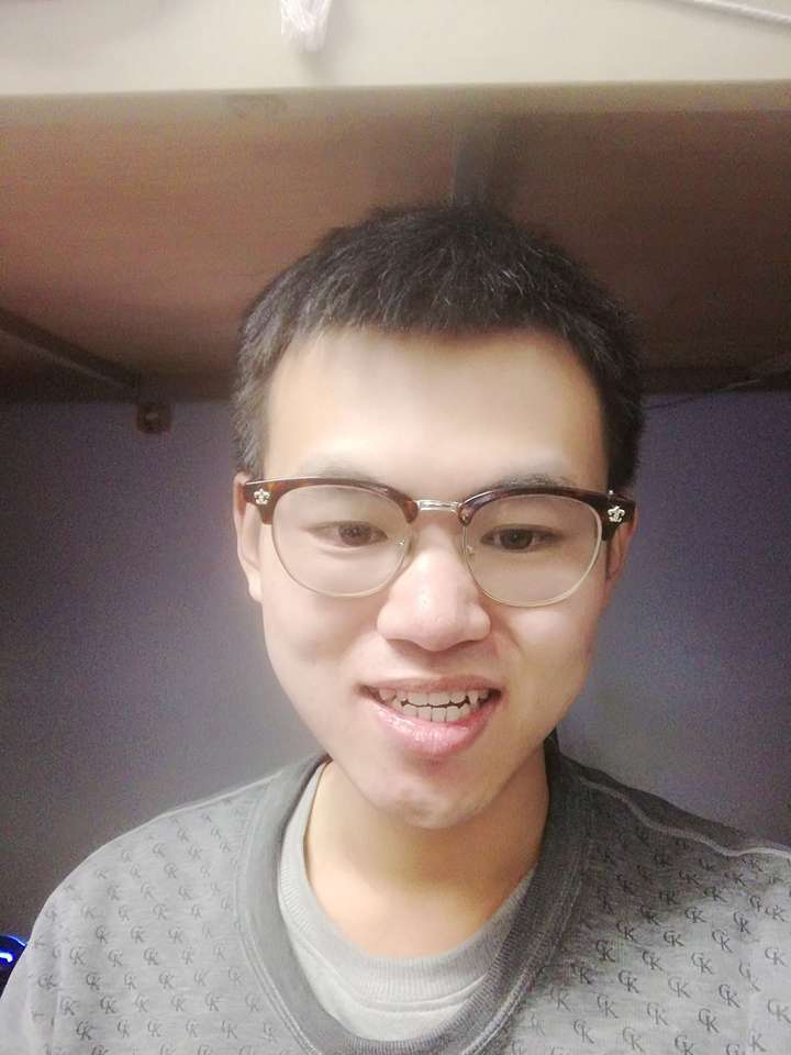 牙齿地包天(兜齿)是怎样的一种体验?