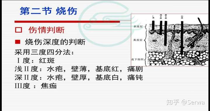 烧伤病人面积和深度估计及烧伤补液量计算方法