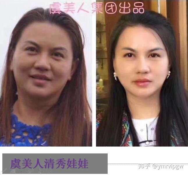 打瘦脸针,有没有什么危害?