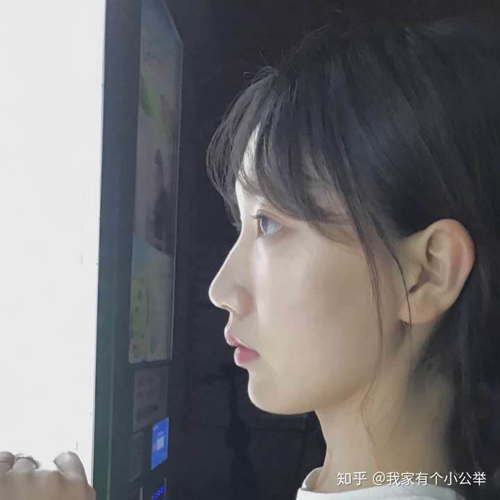 减肥对侧脸颜值有多大影响?