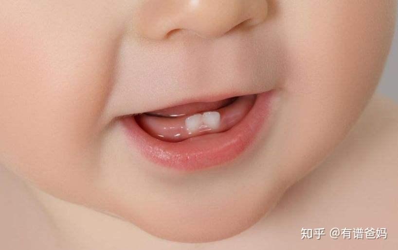 宝宝长牙需要注意什么