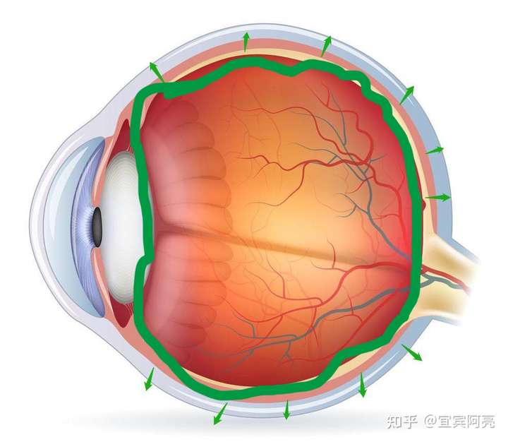 玻璃体占眼球的体积