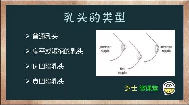 乳头短平宝宝嘬不住用奶嘴套胸上喂孩子孩子没有直接刺激乳头跟乳晕会