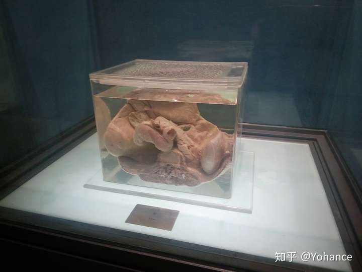杭州自然博物馆里的人体标本是真的吗?