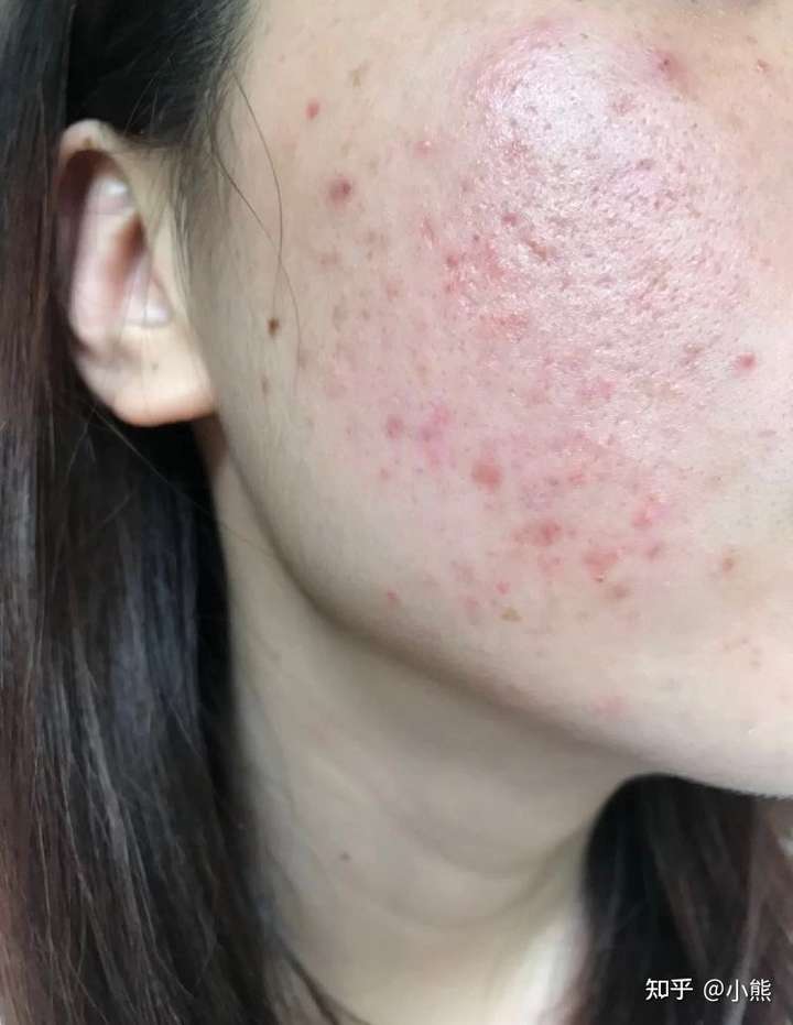 怎么才能让脸部皮肤紧致?