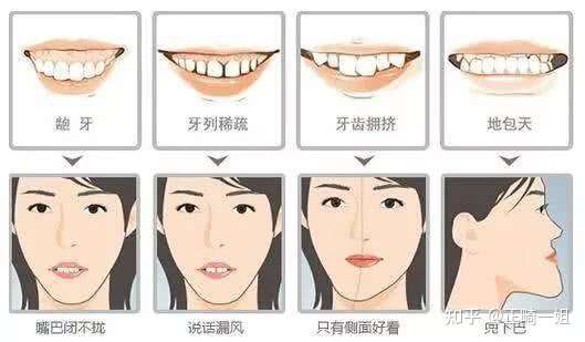 这样的牙应该怎么改善?