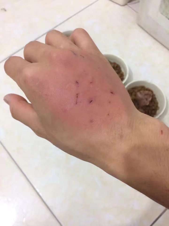 被猫咬了皮肤跟蚊子咬了一样的反应是怎么回事?