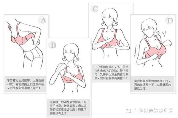 胸外扩可以改善吗?