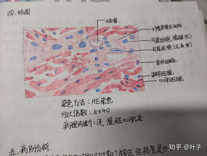 病理学红蓝铅笔绘图