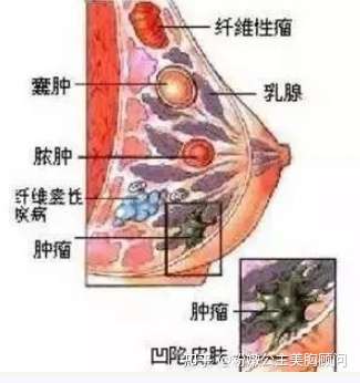 胸部有硬块是什么原因