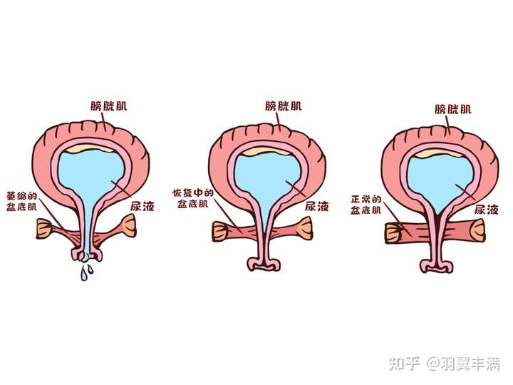 顺产生孩子会使骨盆变大,那剖腹产会使骨盆变大吗?