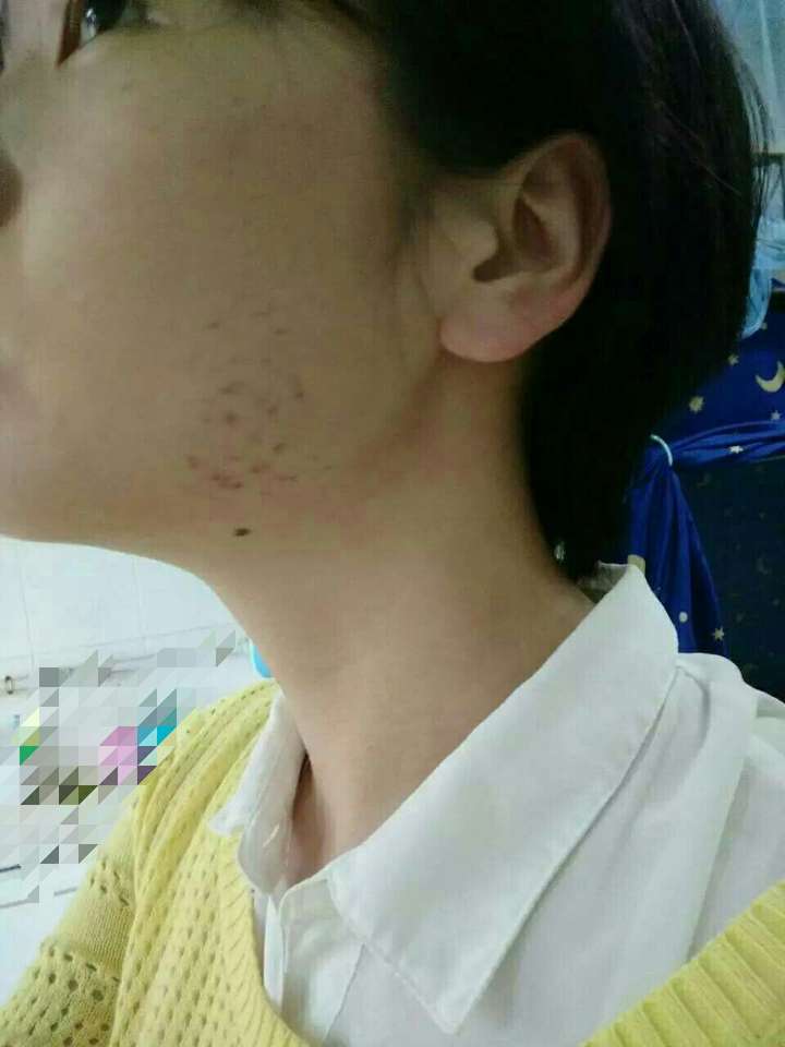 大家都得过什么奇怪的病?