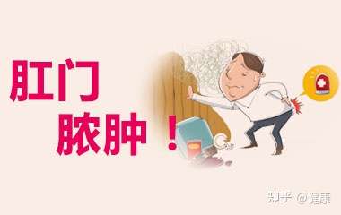 我现在只是一个小小的硬块医生说是肛周脓肿没有脓这个需要动手术吗