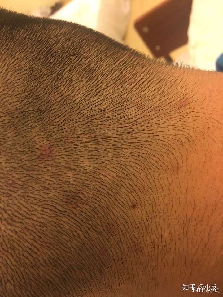 请问大家脸上有这种症状怎么去选择护肤品怎么保养皮肤男生