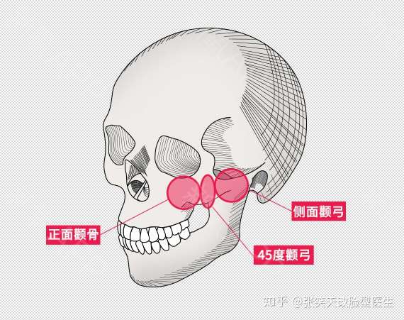 颧骨共有四个突起,分别是:额蝶突,颌突,颞突和眶突.