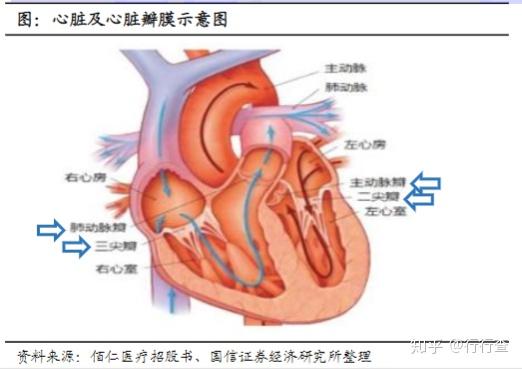 浅析人工心脏瓣膜的发展