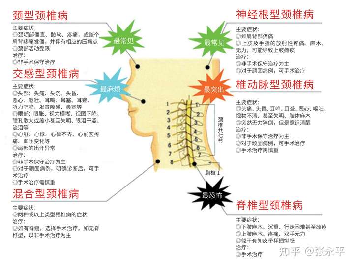颈椎病常见的症状有哪些?