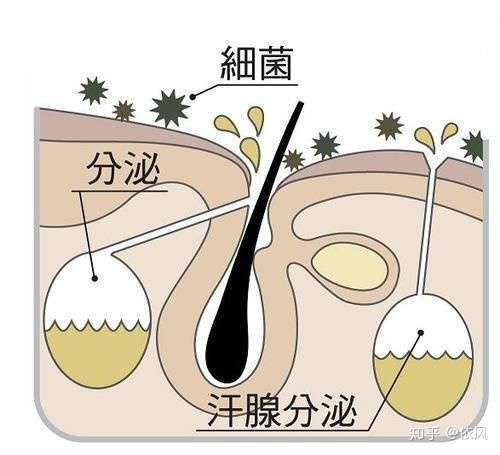 大汗腺分泌物本来不臭,是分泌物被体表的细菌分解以后,生成各种不饱和